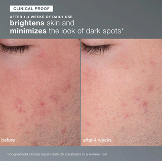 Daily Microfoliant Exfoliator