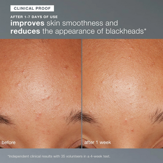 Daily Microfoliant Exfoliator